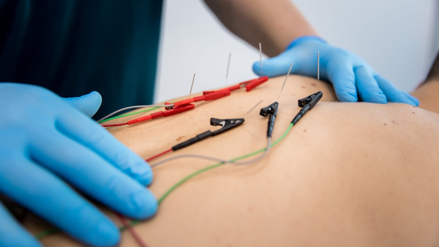 fisio aplicando neuromodulacion